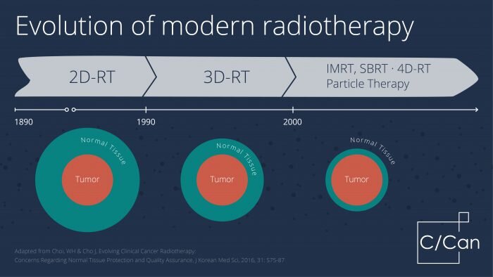 radiotherapy_ccan